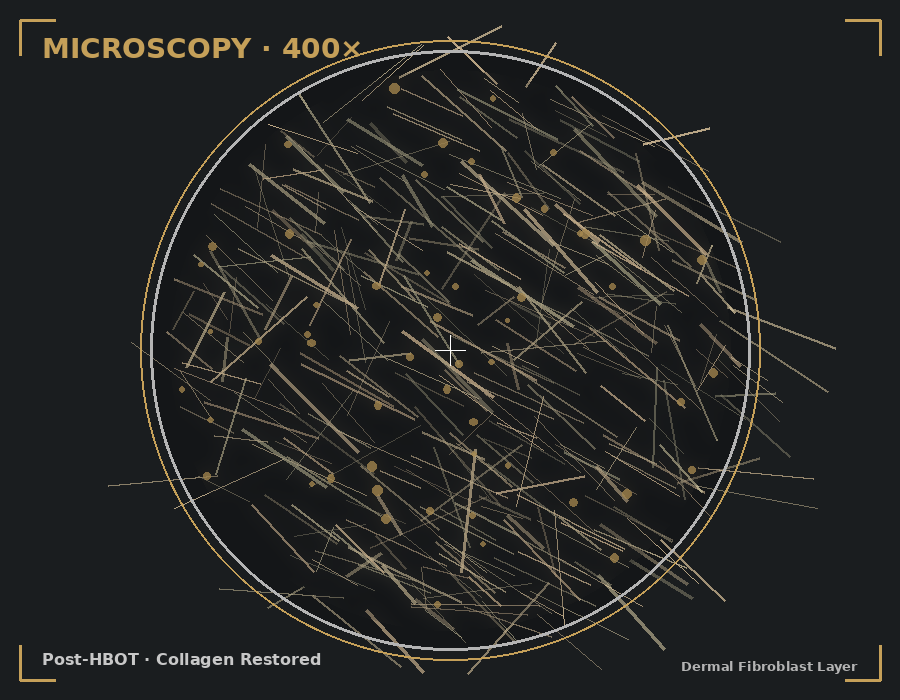 Post-HBOT microscopy showing dense, organized collagen matrix with restored fibroblast activity