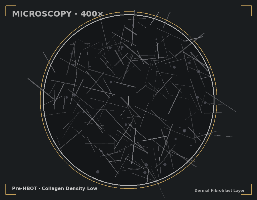 Pre-HBOT microscopy showing sparse, disorganized collagen fibers in dermal layer