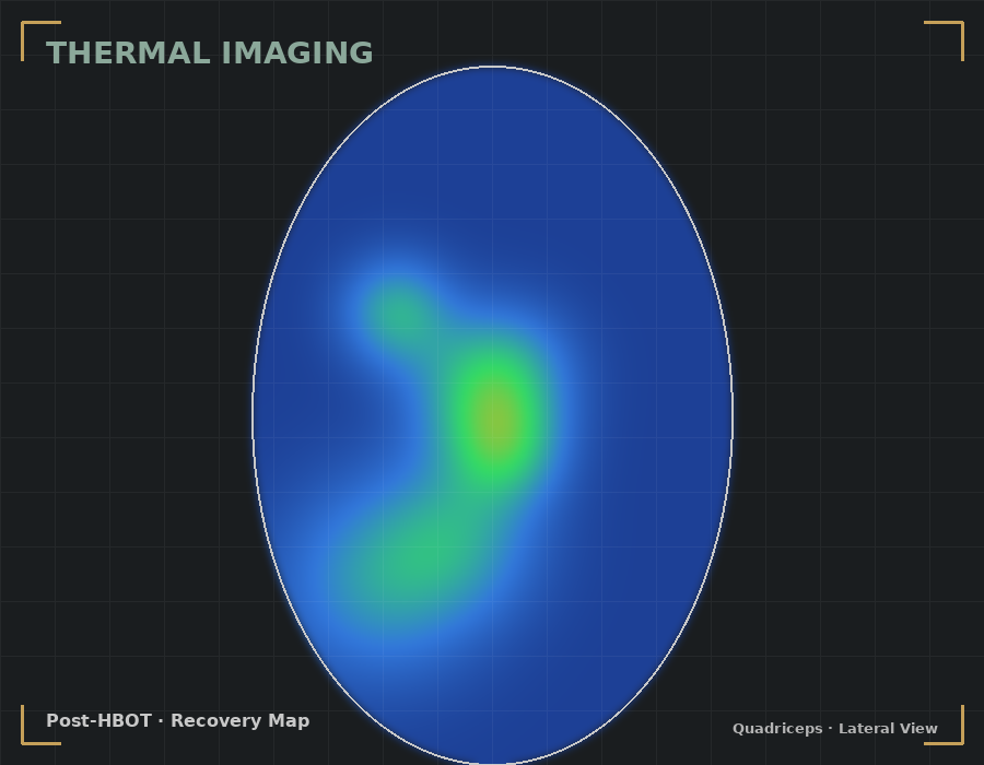 Post-HBOT thermal imaging showing reduced inflammation and recovered muscle tissue