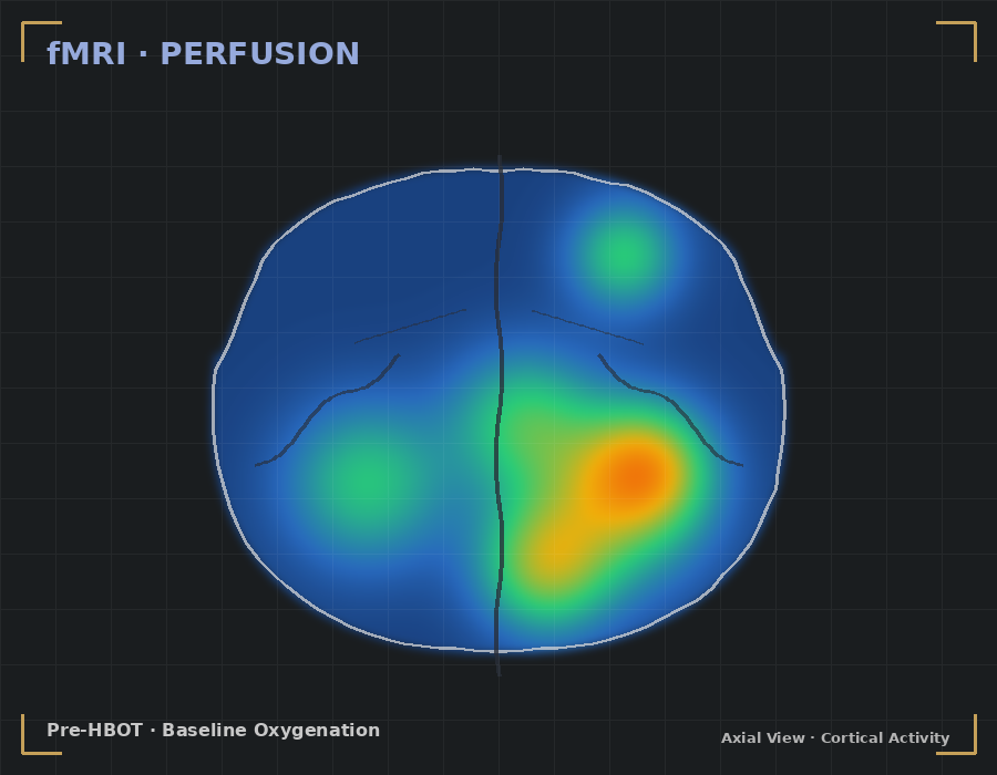 Pre-HBOT fMRI perfusion map showing baseline cortical oxygenation in axial view